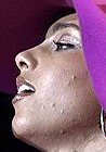 alicia keys acne